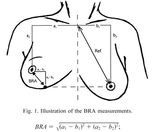 Why Is One Breast Bigger Than the Other?