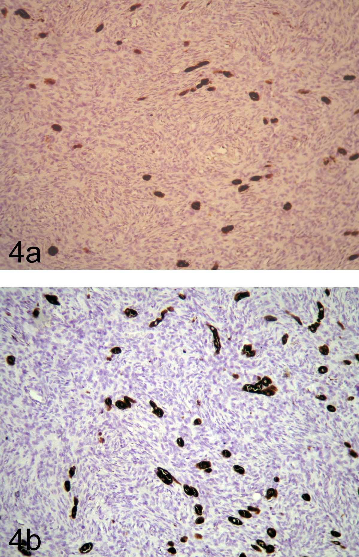 Connolly surfaces of DEET, 220 SS and PIC RS . Hypothetical